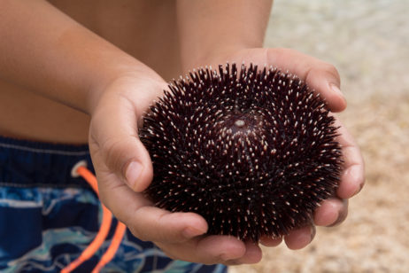 Sea Urchin In Hands